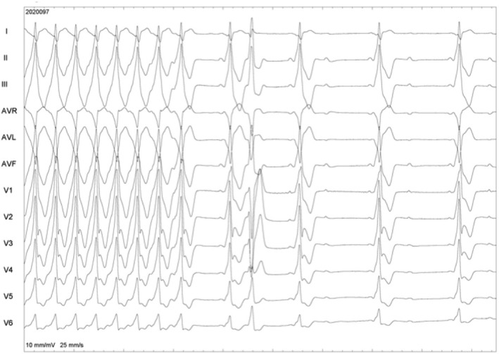 FIGURE 11