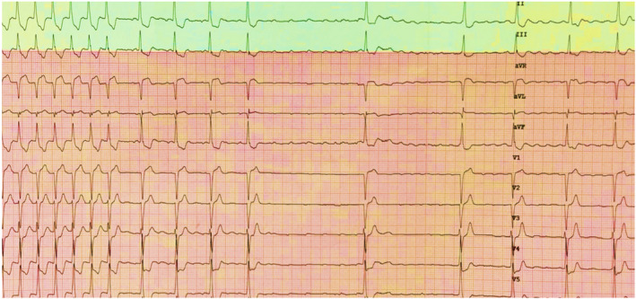 FIGURE 7