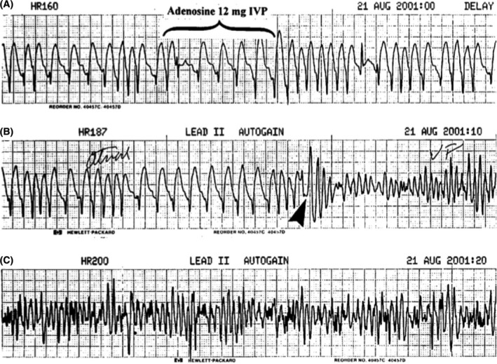 FIGURE 10