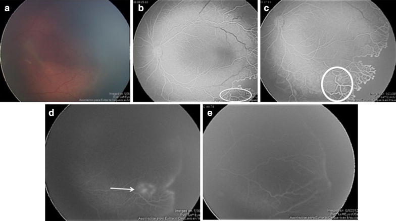 Fig. 2