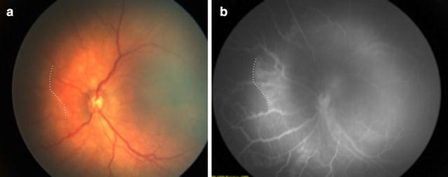 Fig. 1