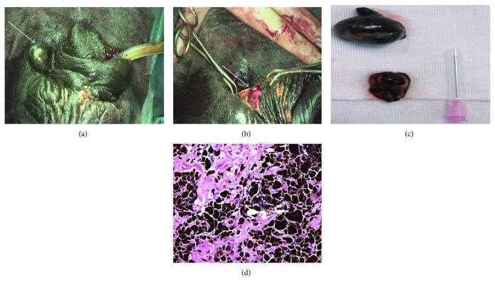 Surgical Management of Penile and Preputial Neoplasms in Equine with ...