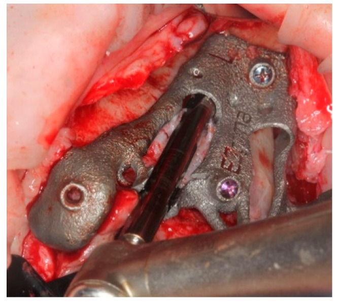 Figure 14