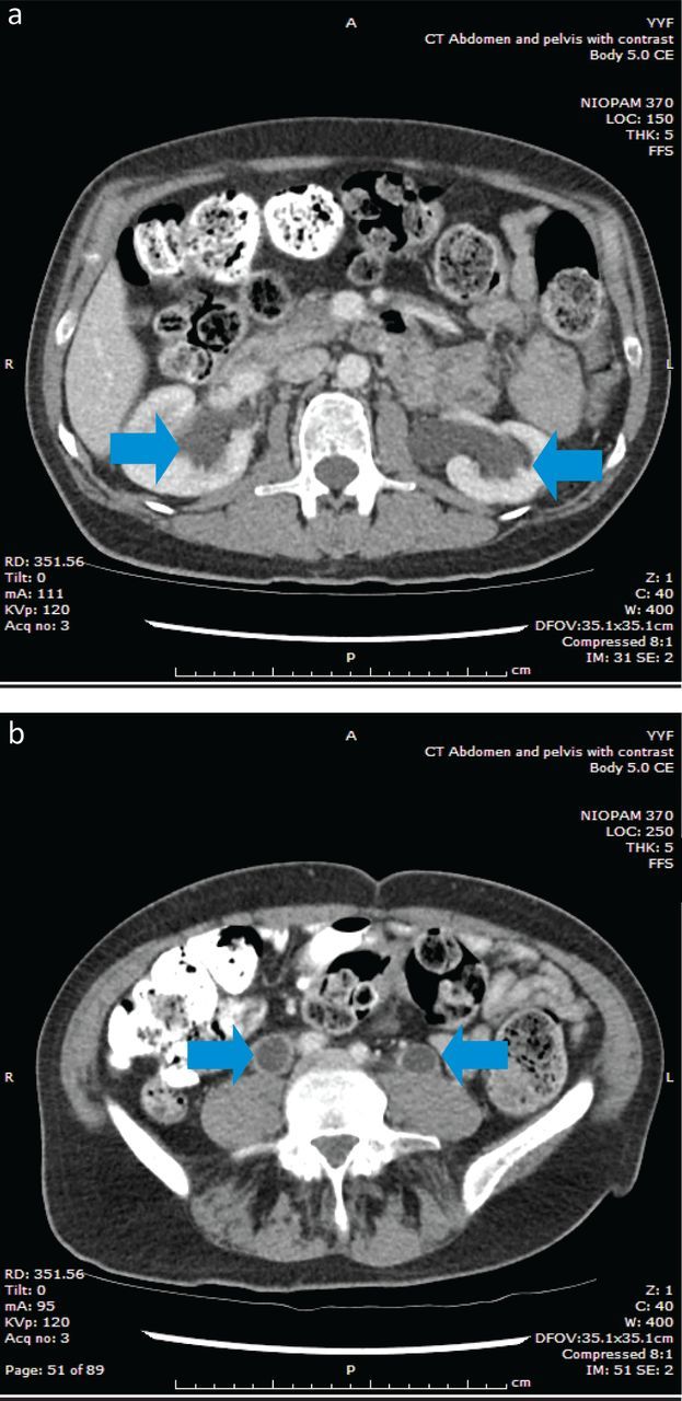 Fig 2.