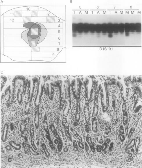 graphic file with name jclinpath00259-0046-a.jpg