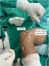 Fig 12