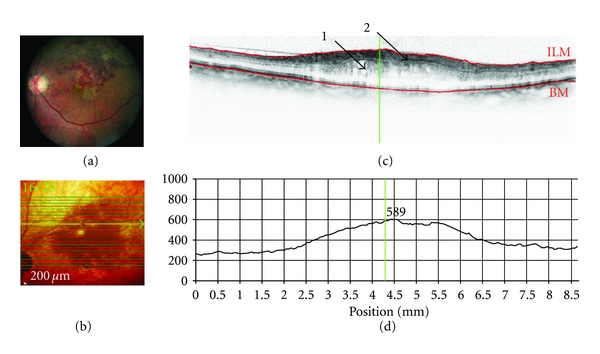 Figure 5