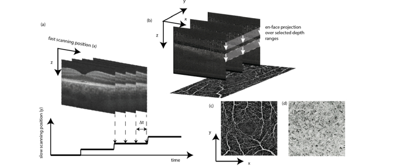 Fig. 12