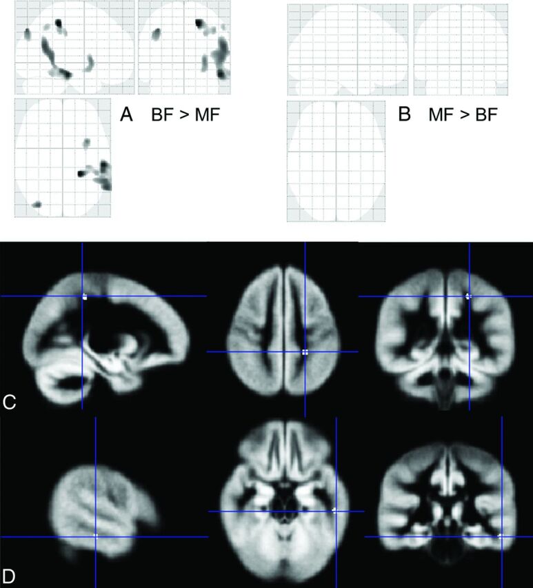 Fig 2.