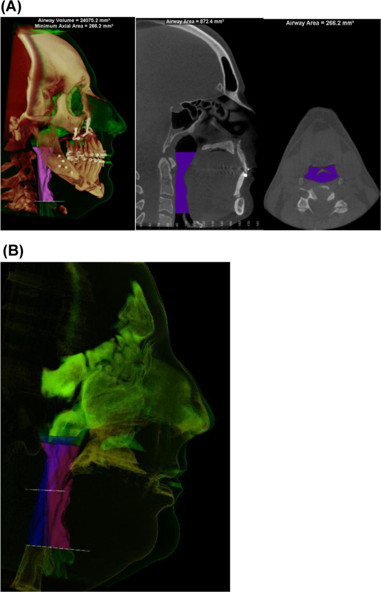 Fig. 8