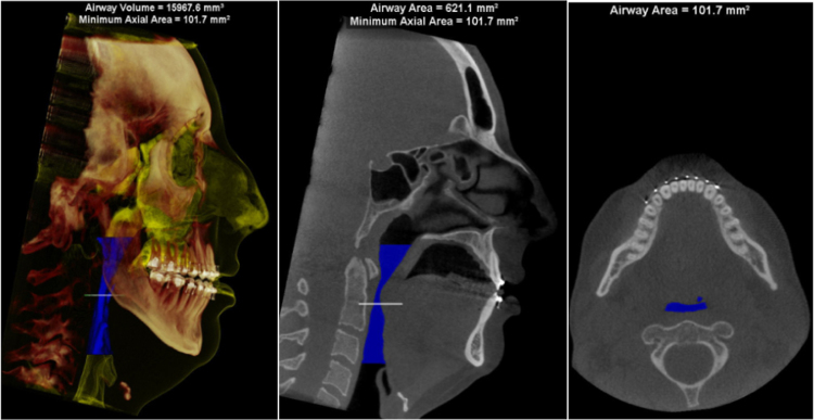 Fig. 6