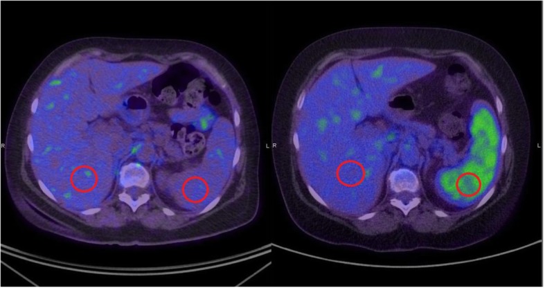 Fig. 1