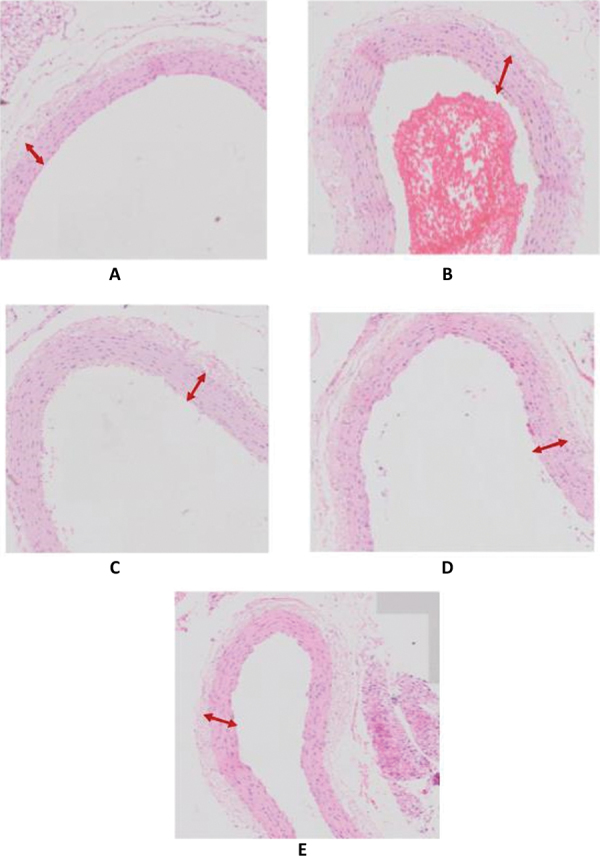 Fig. 1 -