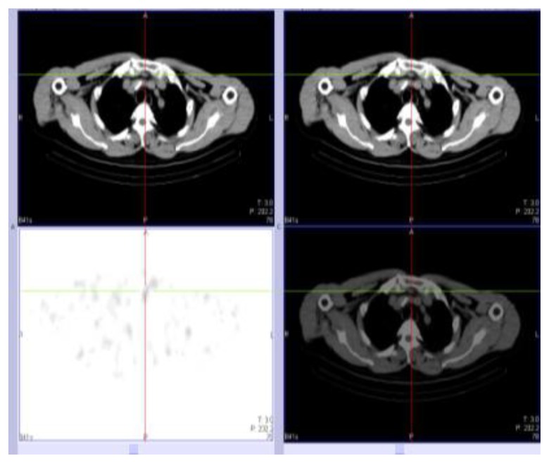 Fig. 5