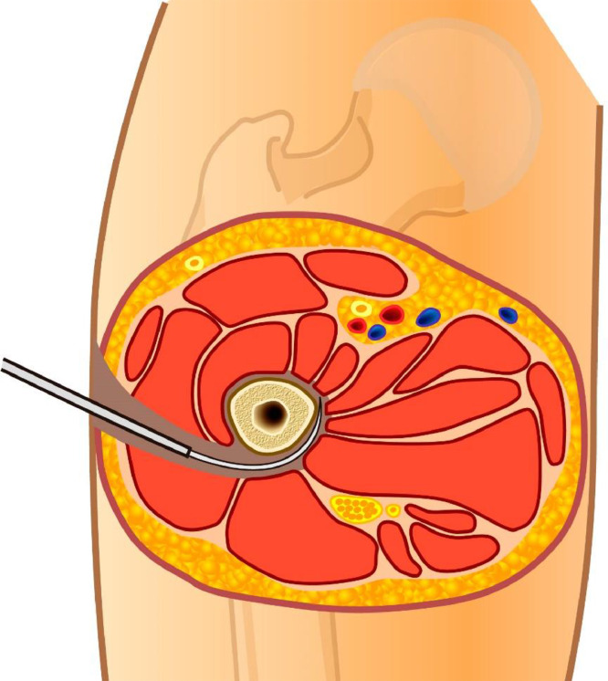 Figure 4: