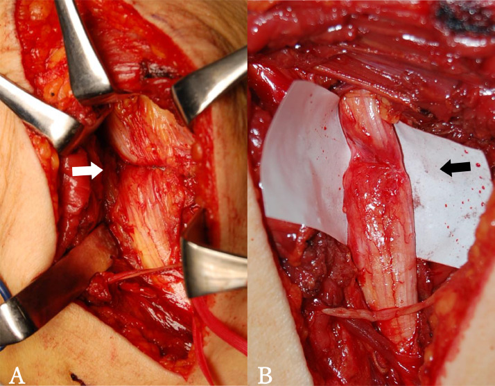 Figure 3: