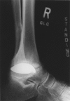 Figure 4B