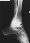 Figure 4C
