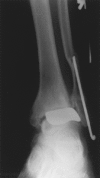 Figure 3B