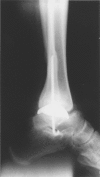 Figure 3A