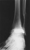 Figure 4A