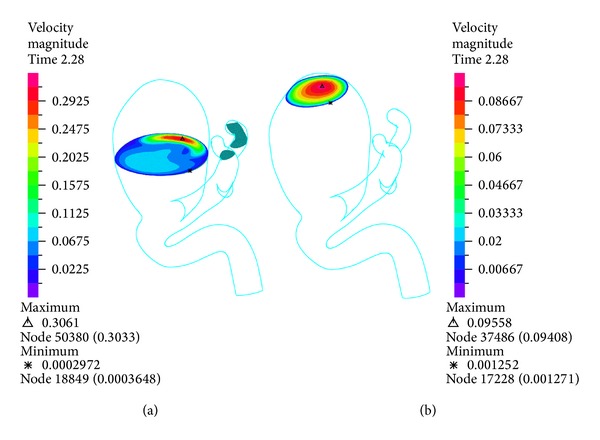 Figure 11