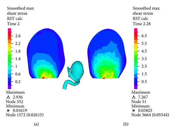 Figure 14