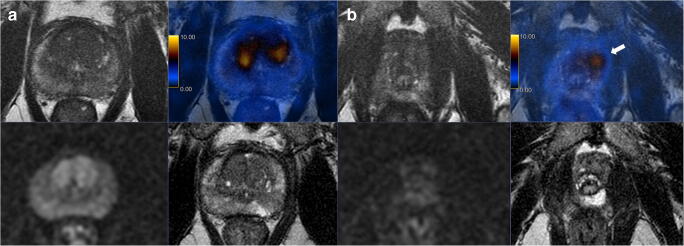 Fig. 4