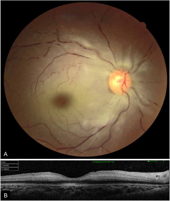 Fig. 3