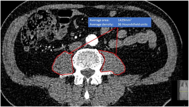 Figure 2.