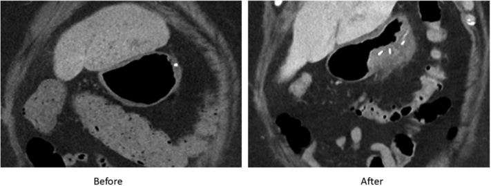 Figure 4