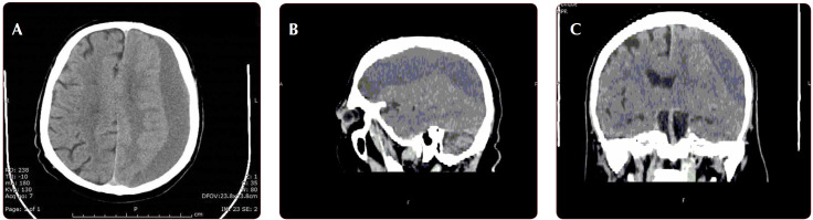 FIGURE 1 