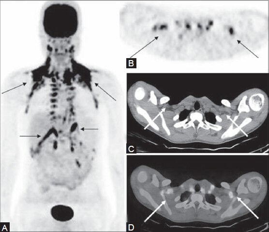 Figure 23 (A-D)