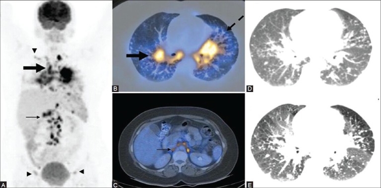 Figure 21 (A-D)