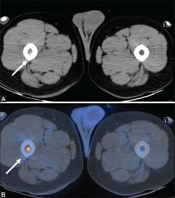 Figure 3 (A, B)