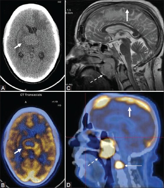 Figure 15 (A-D)