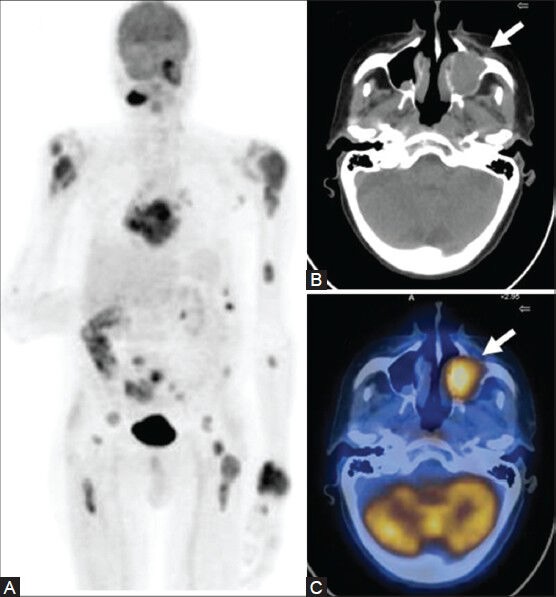 Figure 18 (A-C)