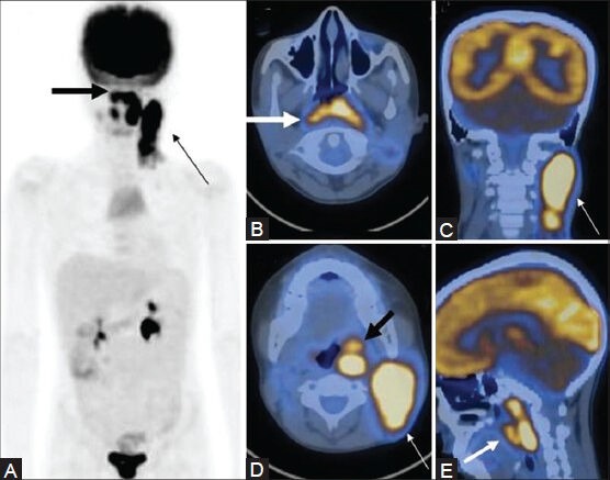 Figure 16 (A-E)