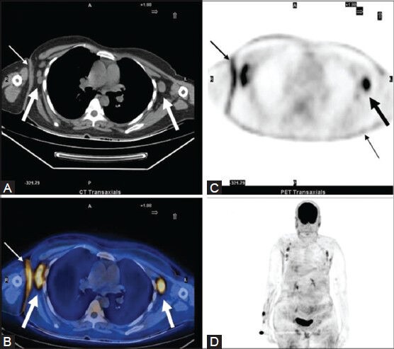 Figure 20 (A-D)