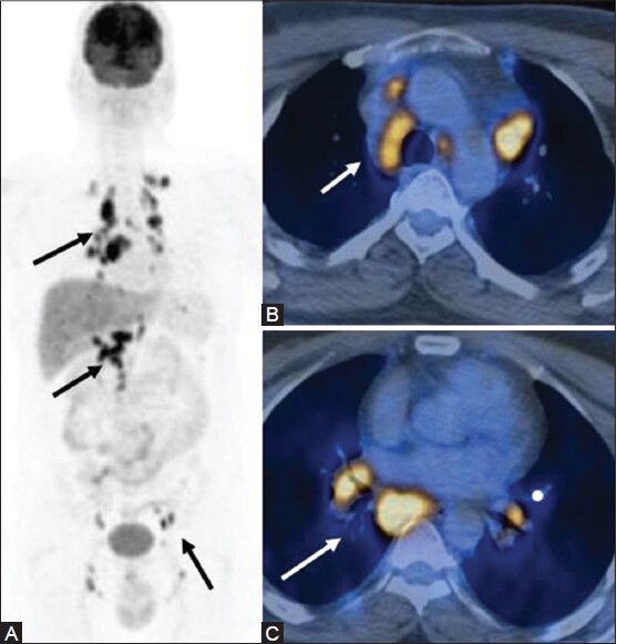 Figure 22 (A-C)