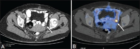 Figure 4 (A, B)