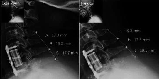 Fig. 1