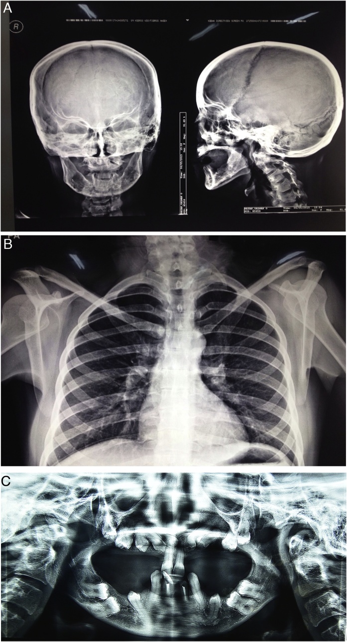 Fig. 2