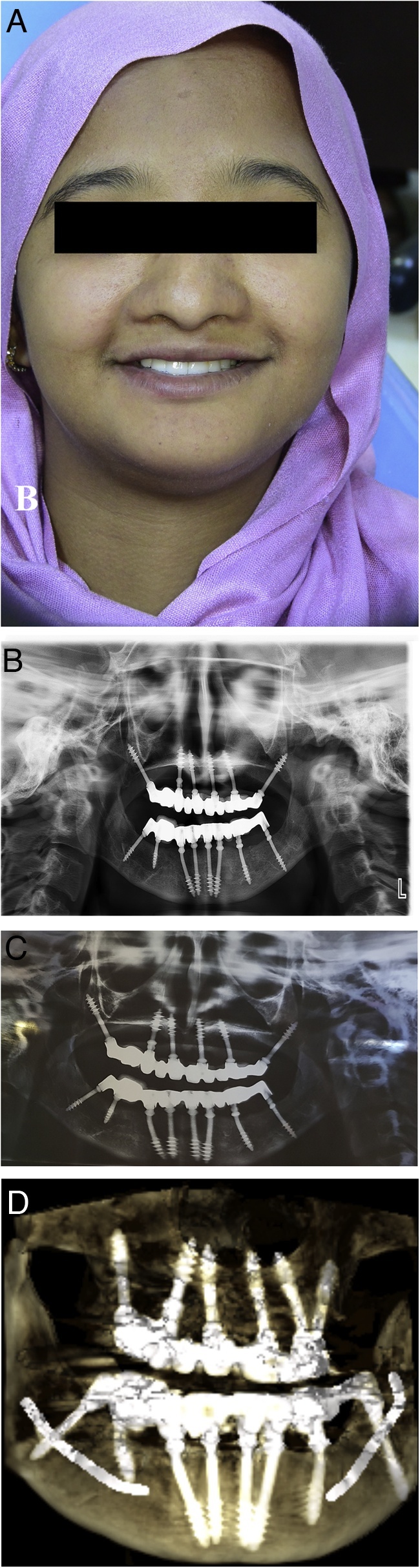 Fig. 4