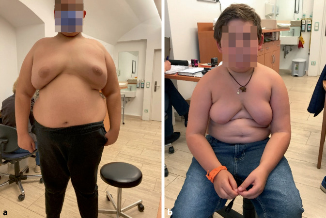 graphic file with name 608_2022_1012_Fig1_HTML.jpg