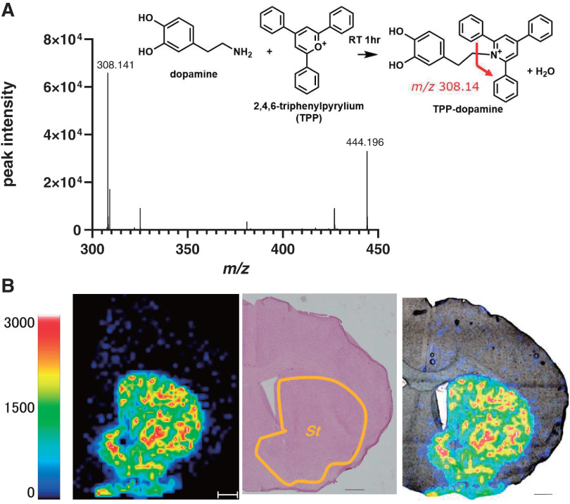 Fig. 2. (A) Molecular structure and mass spectrum of TPP-DA produced by the reaction of TPP and DA. m/z 308.14 is the MSMS spectrum of TPP-DA and m/z 442.19 is the MS spectrum of TPP-DA. (B) Distribution of TPP-DA in coronal sections of mouse brain tissue. Compared with HE staining of post-measured sections. The scale bar is 500 µm. DA, dopamine hydrochloride; HE, hematoxylin and eosin; MS, mass spectrometry; St, striatum; TPP, triphenylpyrylium tetrafluoroborate.