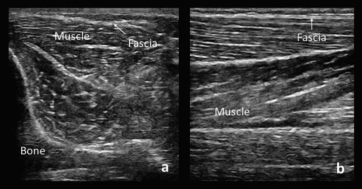 Fig. 12