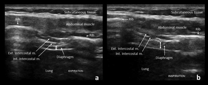 Fig. 13