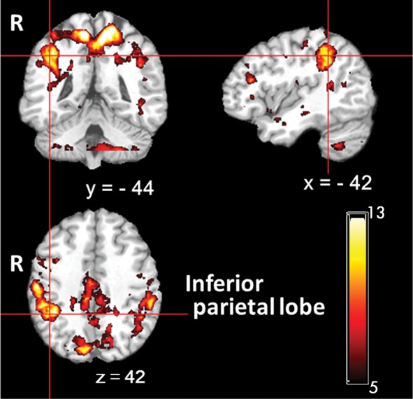 Figure 2b: