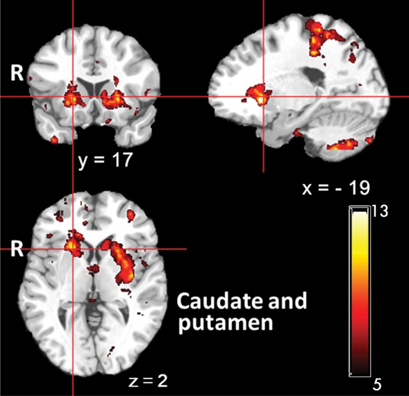 Figure 2d: